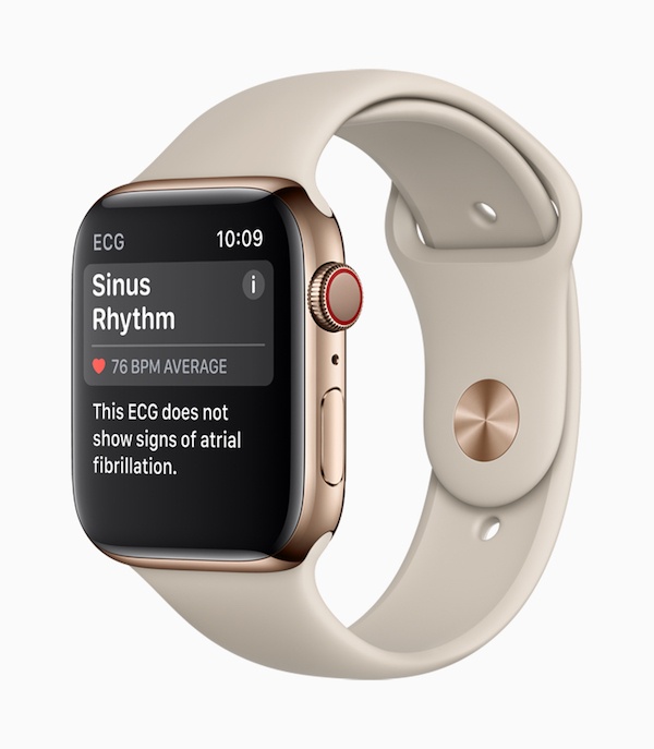 Apple Watch-Series4_ECG-SinusRhythm_09122018